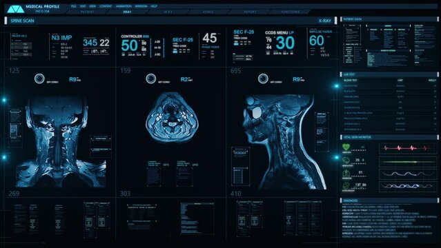 Medical Profile of Patient Showing Neck MRI Scan. Animation Showing Top, Front, Lateral View. Vital Signs and Several Healthcare Information Charts and Data. Futuristic Technological Interface.