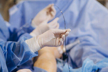 Doctor surgery foot Suture,Percutaneous transluminal angioplasty ,Vascular bypass blood vessel graft surgery ,leg - obrazy, fototapety, plakaty