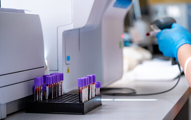Modern laboratory for blood testing. Hospital healthcare clinic tube analyzing.