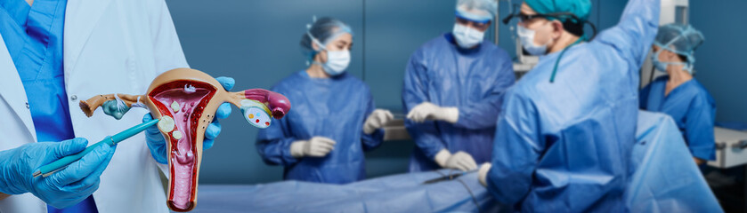 Gynecological surgery. Team of surgeons performing gynecological surgery on a patient with uterine fibroids