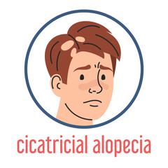Cicatricial alopecia vector isolated. Sad man portrait, hair loss, medical condition. Autoimmune disease. Receding hair, unhealthy condition.