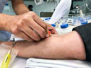 Blood platelet donation, a male nurse inserts a needle into donor’s arm to draw blood at a hospital.