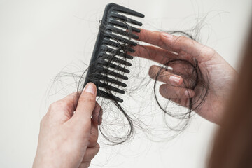 Asian woman have problem with long hair loss attach to comb brush.