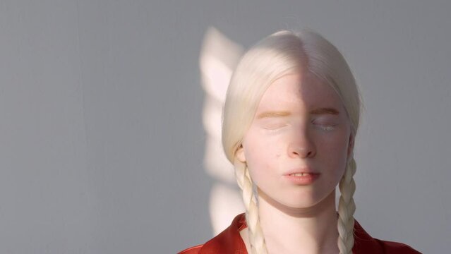 Gentle tender albino teen girl, pretty model with braids wearing red shirt standing lit with sun light on white studio background. Inclusive unusual natural beauty, inclusion, albinism and diversity.