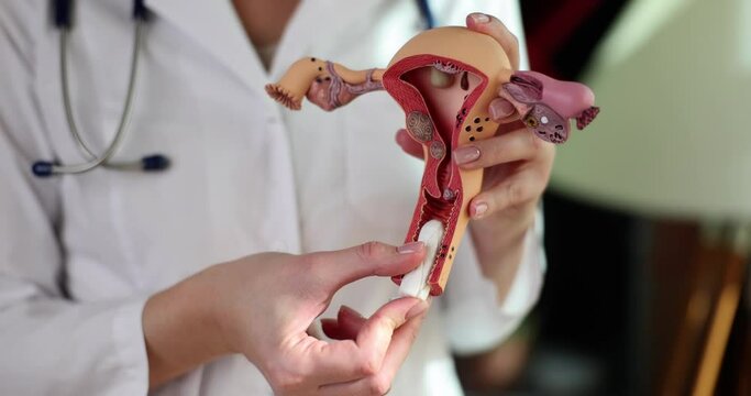 Female doctor inserts tampon into vaginal opening of realistic uterus model. Specialist demonstrates correct use of menstrual hygiene product slow motion