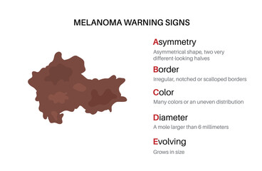 Melanoma warning signs