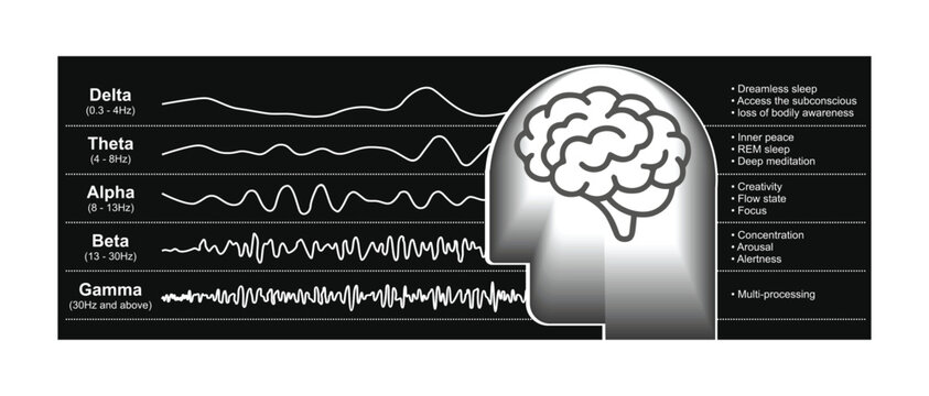 Different kinds of waveforms are produced by brain activity. Demonstration of human brain waves patterns