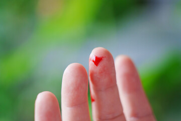 cut on the finger. blood from a wound on arm on the background of plants