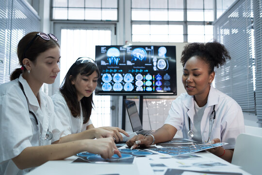 Group of female medical scientists meeting in brain research lab by monitor showing MRI, CT scans brain images. Group of doctors discuss treatment for brain patients, showing images on monitor