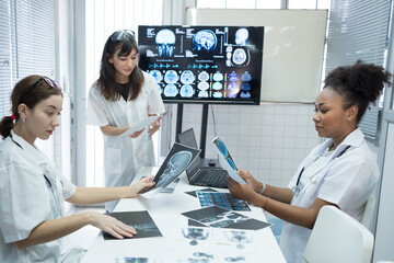 Group of female medical scientists meeting in brain research lab by monitor showing MRI, CT scans brain images. Group of doctors discuss treatment for brain patients, showing images on monitor