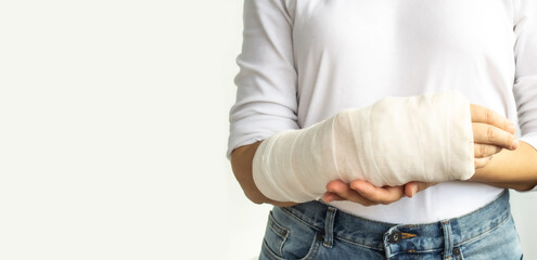 Close-up of a woman's broken arm in a cast. The girl holds a bent arm against the background of a white T-shirt .Appropriate treatment in Western medicine.