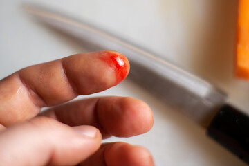 finger cut in the kitchen. Male finger with a wound and blood on a blurred background of a kitchen...