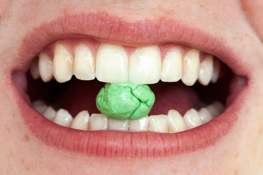Green chewing gum in-between teeth in a human mouth; Lincoln, Nebraska, United States of America