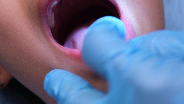 Close-up inside the oral cavity of a healthy child with beautiful rows of baby teeth. Young girl opens mouth revealing upper and lower teeth, hard palate, soft palate, dental and oral health checkup.
