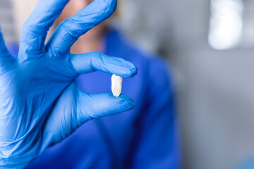 Gloved hand of dentist holding extracted tooth, close-up. Teeth whitening, dental oral hygiene, teeth restoration, dentist day