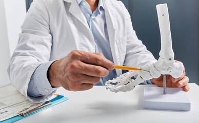 Anatomical foot skeleton model in doctor hands close-up, while consultation in orthopedic clinic....