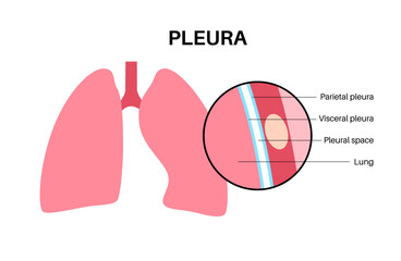 Pleura anatomical poster