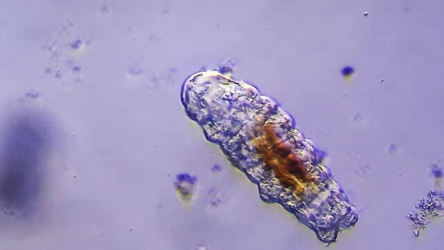 Tardigrade microorganism viewed under microscope