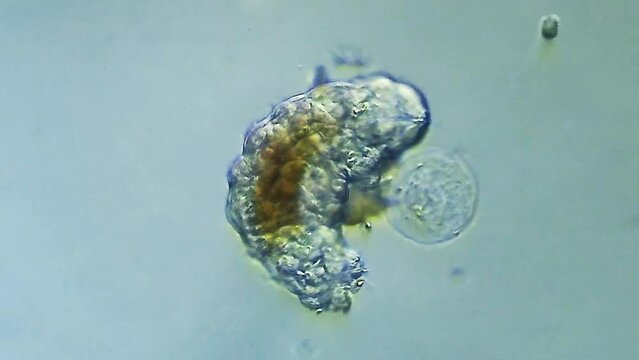 Tardigrade microorganism viewed under microscope