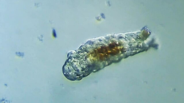 Tardigrade microorganism viewed under microscope
