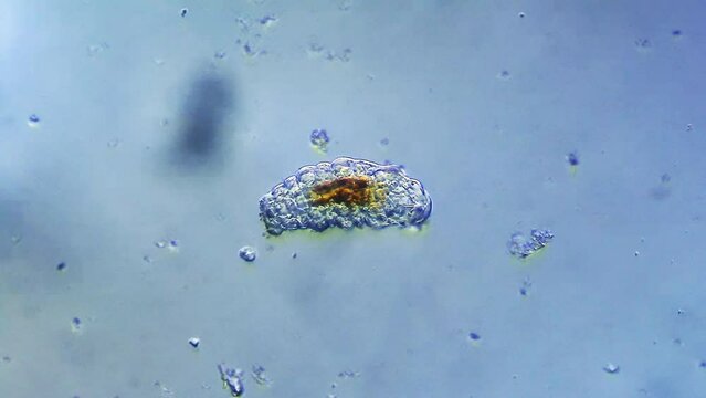 Tardigrade microorganism viewed under microscope