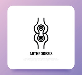 Fototapeta na wymiar Arthrodesis joint surgery thin line icon. Arthritis. Vector illustration.
