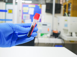 Scientist testing lab in laboratory.