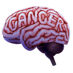 3D human brain illustration curled into word cancer Used in medicine, education and industry.