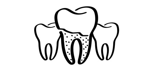 Cartoon healthy, tooth with gums, line pattern. Vector drawing silhouette icon. Damage teeth or tooth with caries. Cracked tooth, mouth and dental, damaged. Strong enamel, disease.