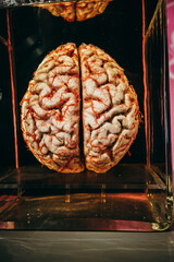 Präparat eines menschliches Gehirns