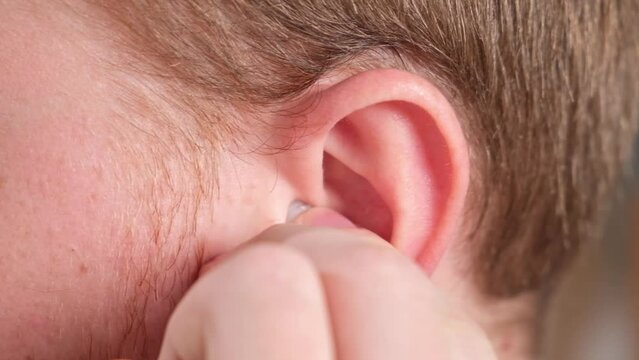A man inserts earplugs in his ears so as not to hear extraneous noise, music, snoring. Silicone earplugs for sleeping.