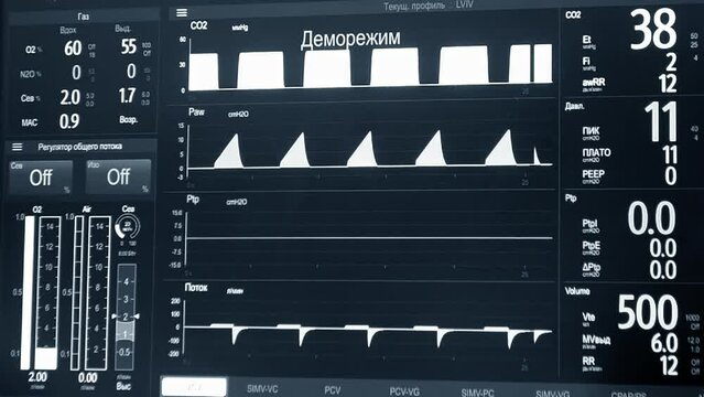 Patient monitor close-up. Monitor with different patient vital signs in hospitals. Image lines, data, indicators, information. Modern medicine equipment tool. Medical monitor. ECG