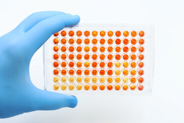Gloved hand with a plate from clinical trials in the laboratory. 