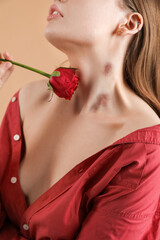 Woman with love bites on her neck and rose flower against color background, closeup