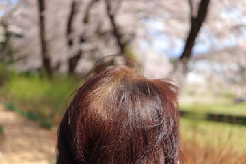 薄毛　女性　シニア　悩み