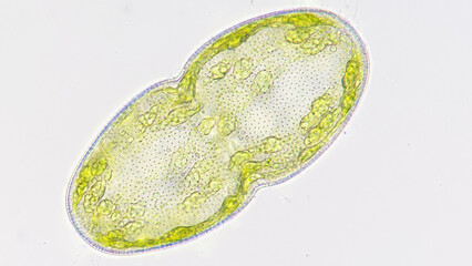 Freshwater microalgae belonging to desmid group, Cosmarium turgidum or also known as Actinotaenium...