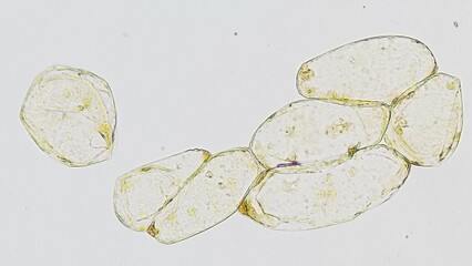 Microscopic view of a banana pulp cells. Stained by lugol iodine. Selective focus