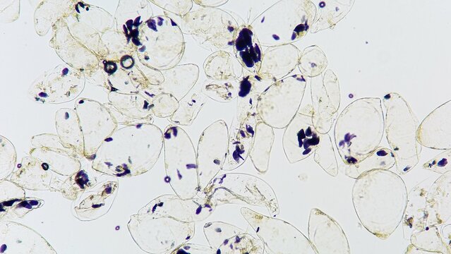 Microscopic view of a banana starch granule in banana pulp cells. Stained by lugol iodine. Selective focus