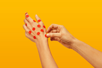 Pox, Hand Sticking red polka dots on another hand, red spots