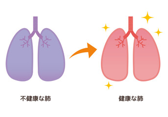 不健康な肺→健康な肺のイメージ
