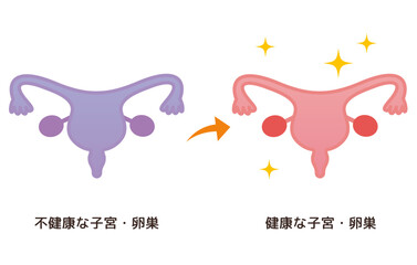 不健康な子宮・卵巣→健康な子宮・卵巣のイメージ