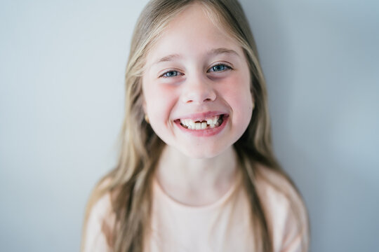 Happy young girl without teeth smiling