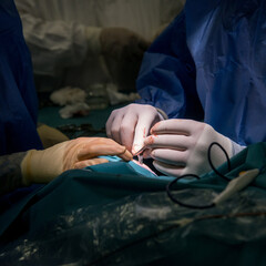 Surgeons gloved hands hold the instruments during surgery operation