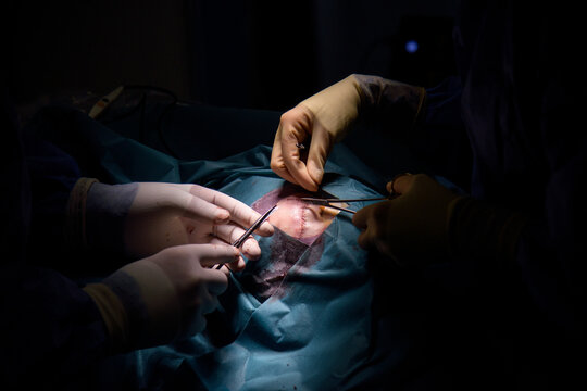 Closeup Of Surgeons Gloved Hands With The Instruments During Face Plastic Surgery Doctor In Gloves Holds Medical Instrument During Wound Suturing