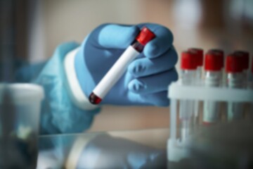 Influenza virus subtype disease concept, Medical concept