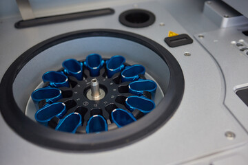 Closeup of a modern robotic machine for blood centrifugation and urinalysis. Hospital laboratories, automatic biochemical analyzer. - obrazy, fototapety, plakaty