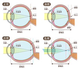 目の構造_視力(近視・遠視・乱視）