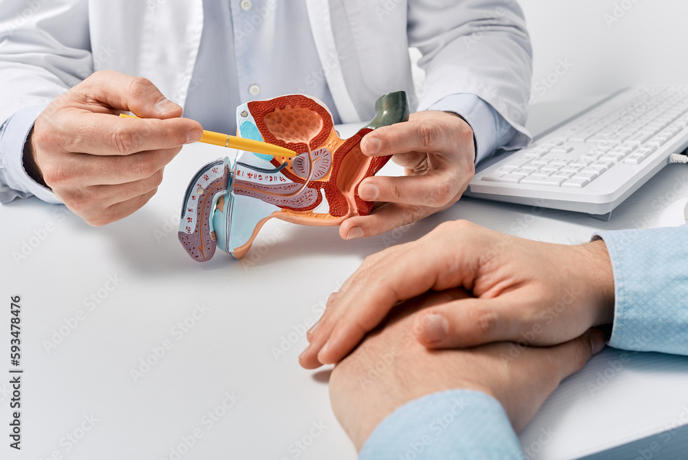 Wall mural Prostate disease and treatment. Male reproductive system anatomical model in doctors hands close-up during consultation of male patient with suspected bacterial prostatitis