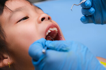 Close-up in the oral cavity of a healthy child with beautiful white teeth. Young girl opens her mouth to reveal healthy teeth, hard and soft palate. Dental and oral health check