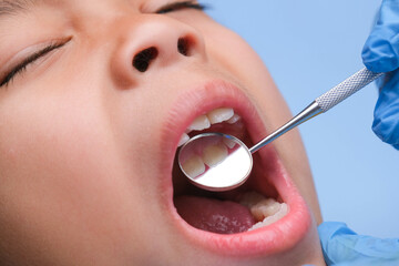 Close-up in the oral cavity of a healthy child with beautiful white teeth. Young girl opens her...